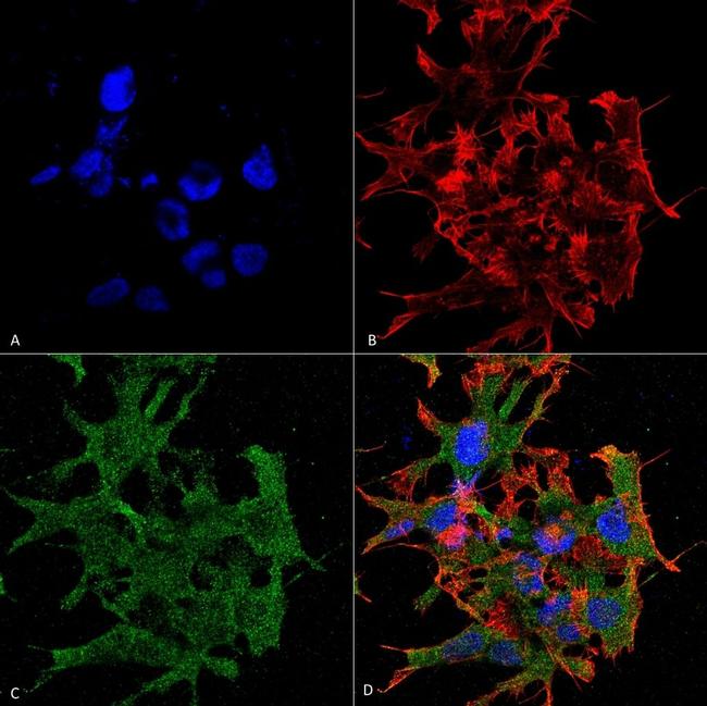 GABBR1 Antibody in Immunocytochemistry (ICC/IF)