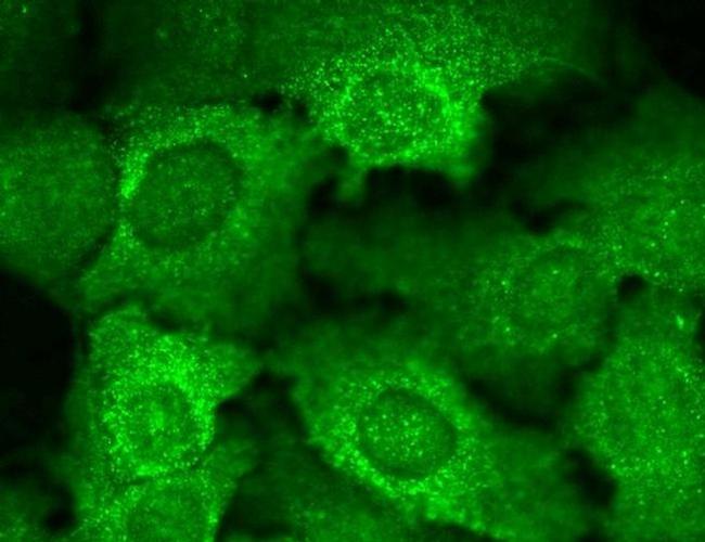 CACNB2 Antibody in Immunocytochemistry (ICC/IF)