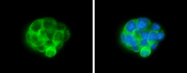 ALDH1A3 Antibody in Immunocytochemistry (ICC/IF)