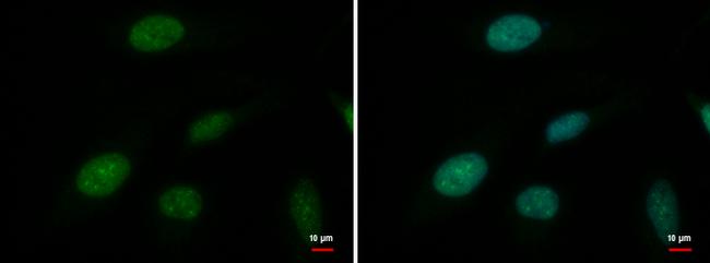 ATRX Antibody in Immunocytochemistry (ICC/IF)