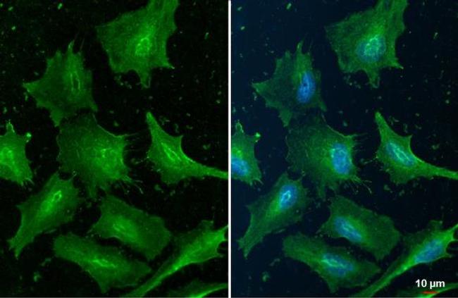 Cofilin Antibody in Immunocytochemistry (ICC/IF)