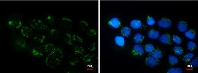 COL11A2 Antibody in Immunocytochemistry (ICC/IF)