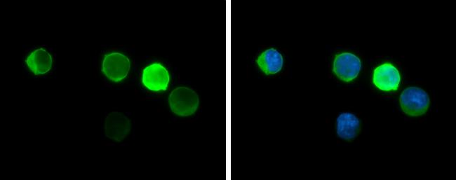 HBZ Antibody in Immunocytochemistry (ICC/IF)