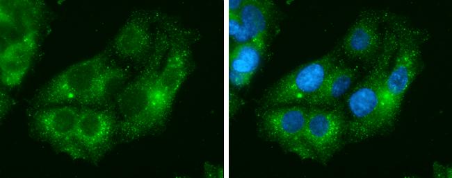 IDH1 Antibody in Immunocytochemistry (ICC/IF)