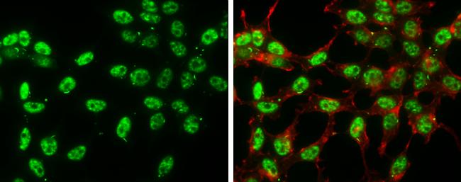 Phospho-c-Jun (Ser63) Antibody in Immunocytochemistry (ICC/IF)