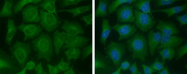 ME1 Antibody in Immunocytochemistry (ICC/IF)