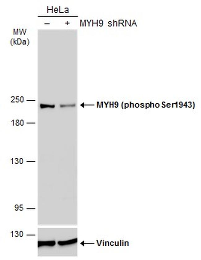 Phospho-MYH9 (Ser1943) Antibody