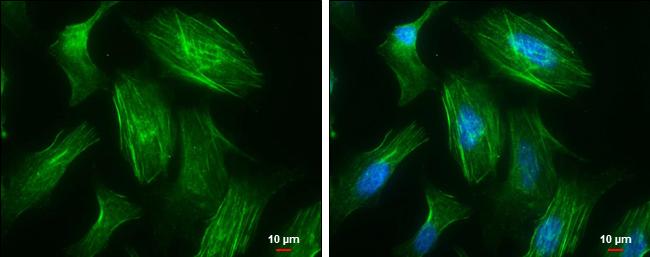 MYH10 Antibody in Immunocytochemistry (ICC/IF)