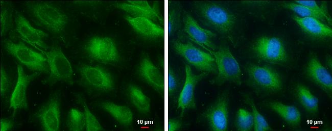 PGAM1 Antibody in Immunocytochemistry (ICC/IF)