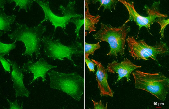 Phospho-Paxillin (Tyr118) Antibody in Immunocytochemistry (ICC/IF)