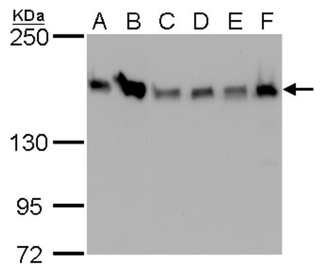 ROCK1 Antibody in Western Blot (WB)