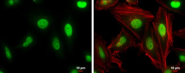 Cullin 4A Antibody in Immunocytochemistry (ICC/IF)