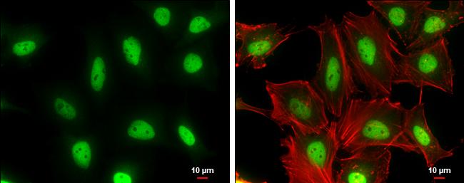 Cullin 4A Antibody in Immunocytochemistry (ICC/IF)