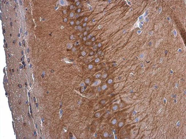 GEF-H1 Antibody in Immunohistochemistry (Paraffin) (IHC (P))