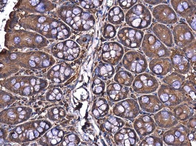 YAP1 Antibody in Immunohistochemistry (Paraffin) (IHC (P))