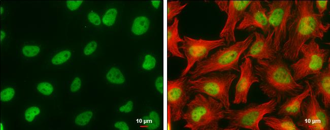 CFDP1 Antibody in Immunocytochemistry (ICC/IF)