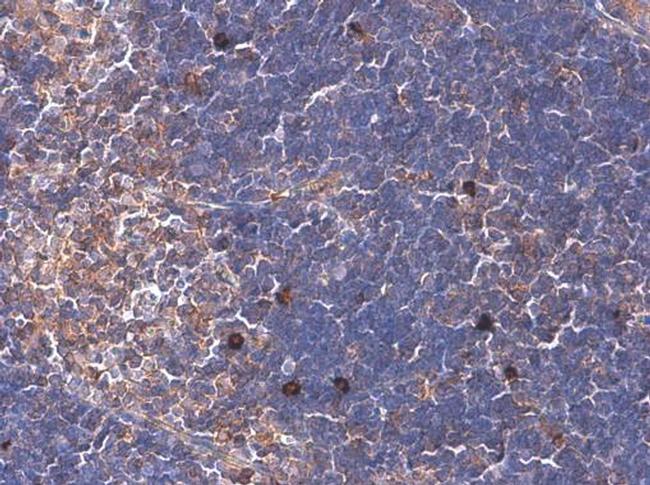 ARHGEF18 Antibody in Immunohistochemistry (Paraffin) (IHC (P))