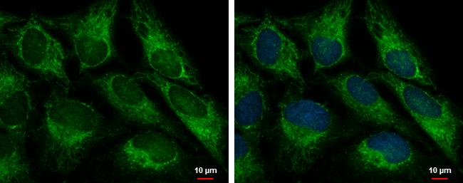 FIS1 Antibody in Immunocytochemistry (ICC/IF)