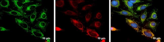 FIS1 Antibody in Immunocytochemistry (ICC/IF)