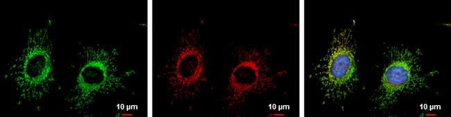 FIS1 Antibody in Immunocytochemistry (ICC/IF)