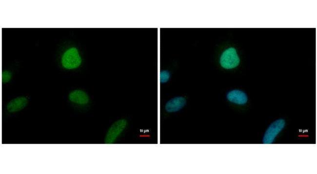 ENY2 Antibody in Immunocytochemistry (ICC/IF)