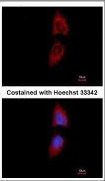 PNPase Antibody in Immunocytochemistry (ICC/IF)