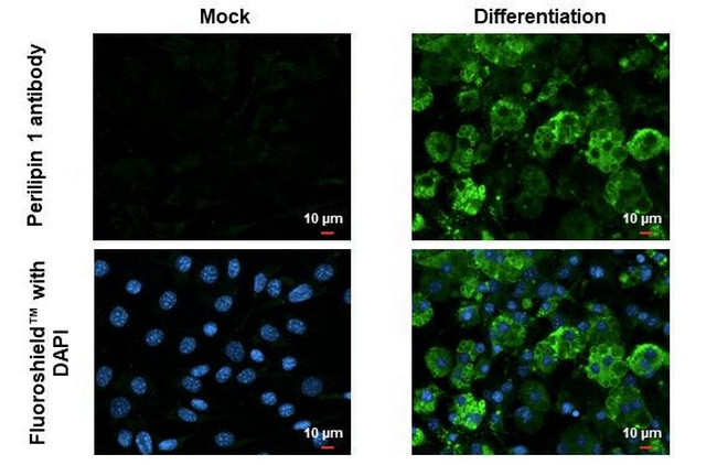 Perilipin 1 Antibody in Immunocytochemistry (ICC/IF)