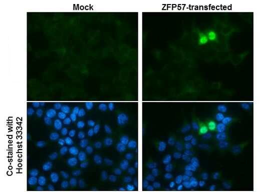 ZFP57 Antibody in Immunocytochemistry (ICC/IF)