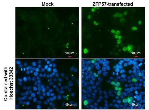 ZFP57 Antibody in Immunocytochemistry (ICC/IF)