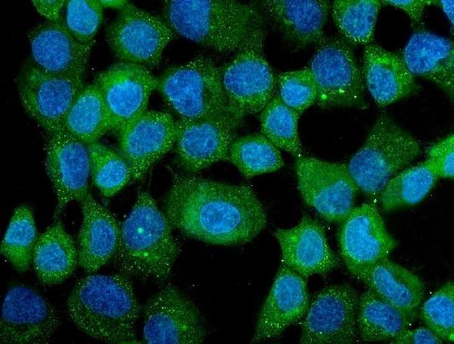 CCT3 Antibody in Immunocytochemistry (ICC/IF)