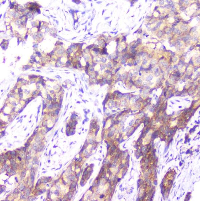 SMN1/SMN2 Antibody in Immunohistochemistry (Paraffin) (IHC (P))