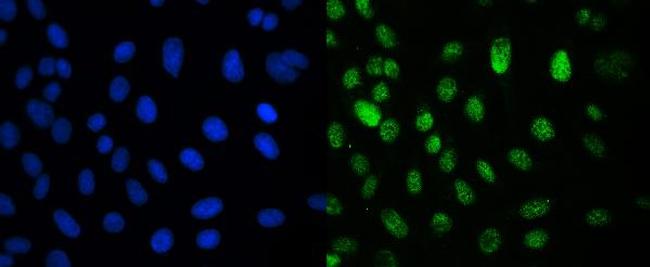 CRM1 Antibody in Immunocytochemistry (ICC/IF)