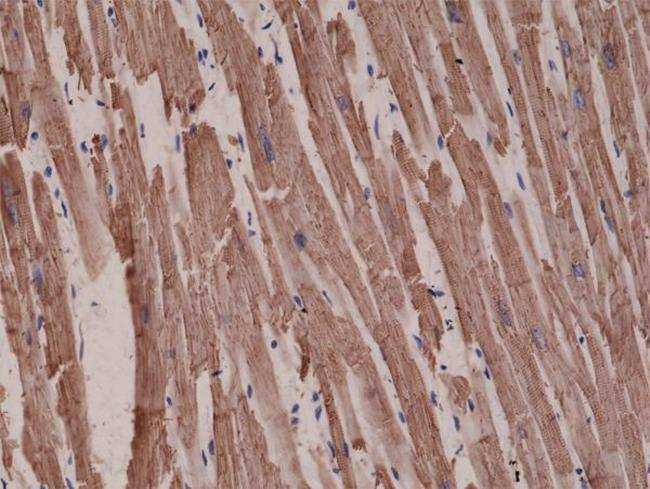 alpha-Cardiac Actin Antibody in Immunohistochemistry (Paraffin) (IHC (P))