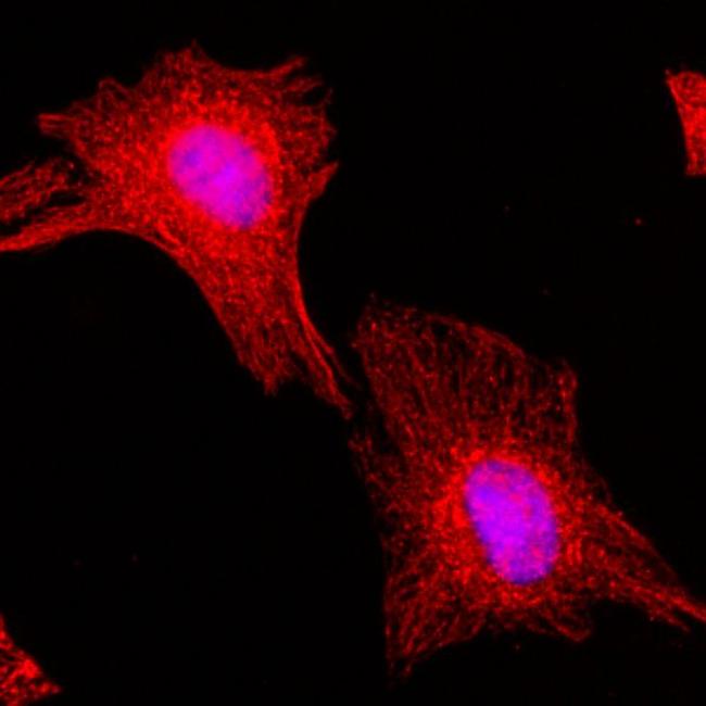 alpha Tubulin Antibody in Immunocytochemistry (ICC/IF)