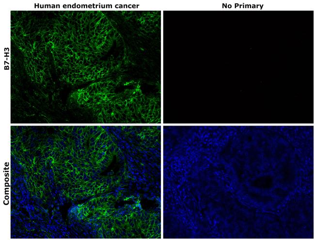 B7-H3 (CD276) Antibody in Immunohistochemistry (Paraffin) (IHC (P))