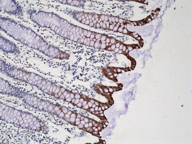 Cytokeratin 20 Antibody in Immunohistochemistry (Paraffin) (IHC (P))