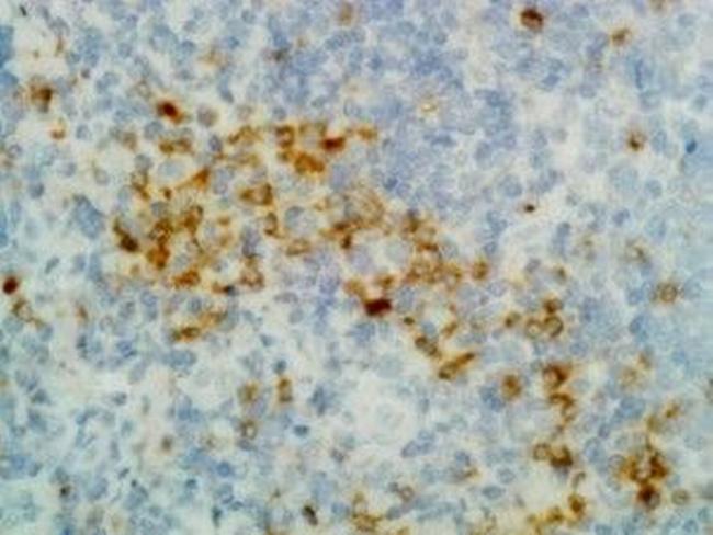 Human IgG (Heavy chain) Secondary Antibody in Immunohistochemistry (IHC)