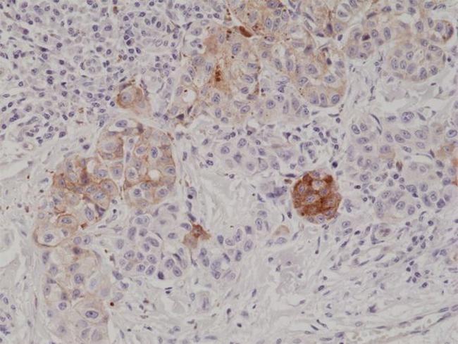 Melan-A Antibody in Immunohistochemistry (Paraffin) (IHC (P))