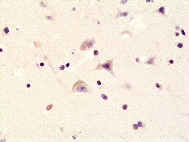 Phospho-GluR1 (Ser845) Antibody in Immunohistochemistry (Paraffin) (IHC (P))