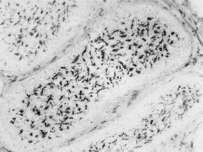 CD115 (c-fms) Antibody in Immunohistochemistry (Frozen) (IHC (F))