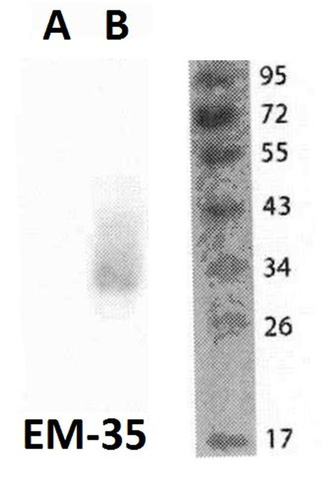 FOLR2 Antibody in Western Blot (WB)