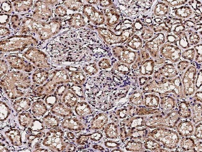 ACOX1 Antibody in Immunohistochemistry (Paraffin) (IHC (P))