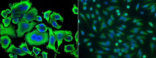 Aminoacylase Antibody in Immunocytochemistry (ICC/IF)