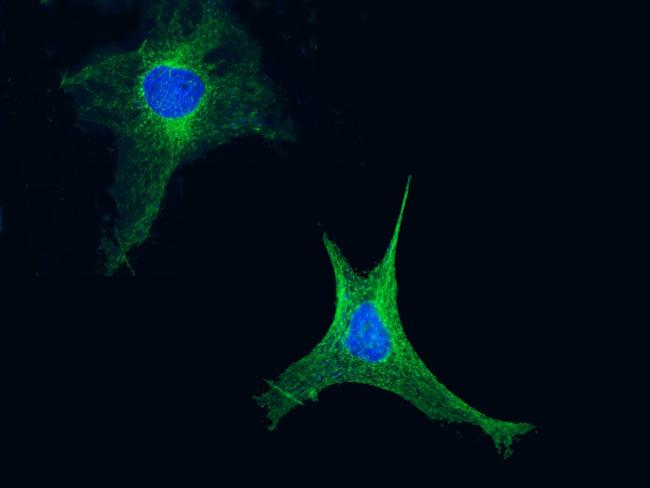 Adenylate Kinase 4 Antibody in Immunocytochemistry (ICC/IF)