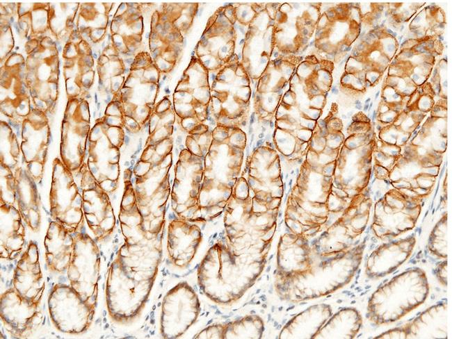 CD147 Antibody in Immunohistochemistry (Paraffin) (IHC (P))