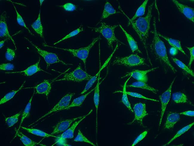 C1QBP Antibody in Immunocytochemistry (ICC/IF)