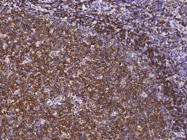 CD22 Antibody in Immunohistochemistry (Paraffin) (IHC (P))