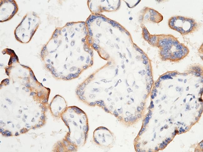 PD-L1 Antibody in Immunohistochemistry (Paraffin) (IHC (P))