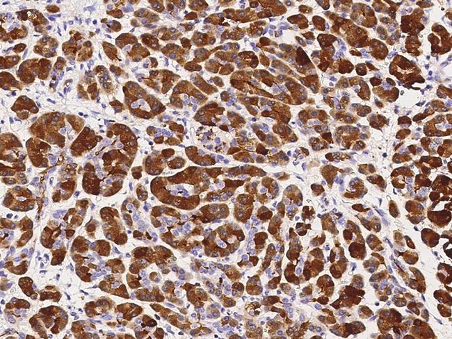 CLPS Antibody in Immunohistochemistry (Paraffin) (IHC (P))