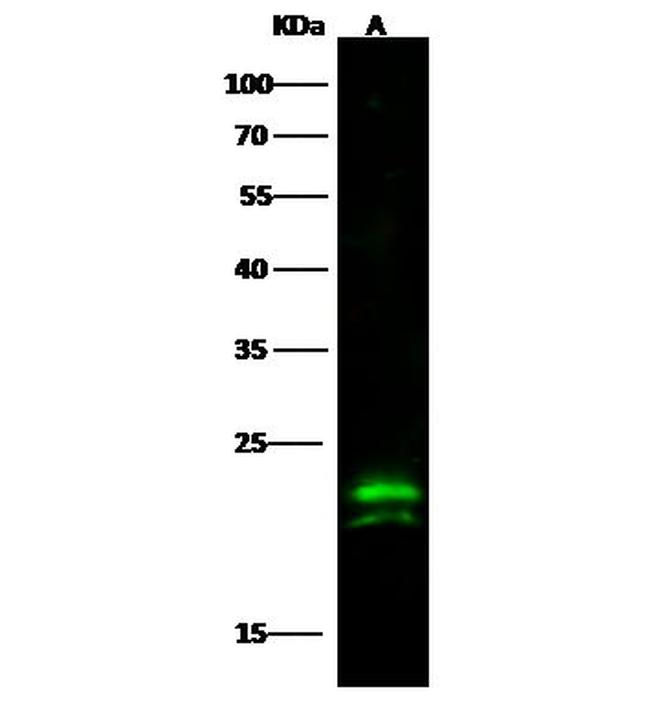 CMPK1 Antibody in Western Blot (WB)